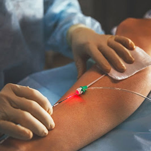 Vascular Surgeries
